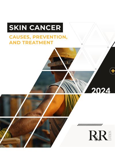 Cover of the R&R Lotion white paper Skin Cancer: Causes, Prevention and Treatment