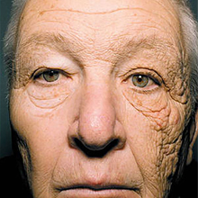 Trucker-Face