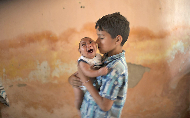 Brazil Zika Birth Defects