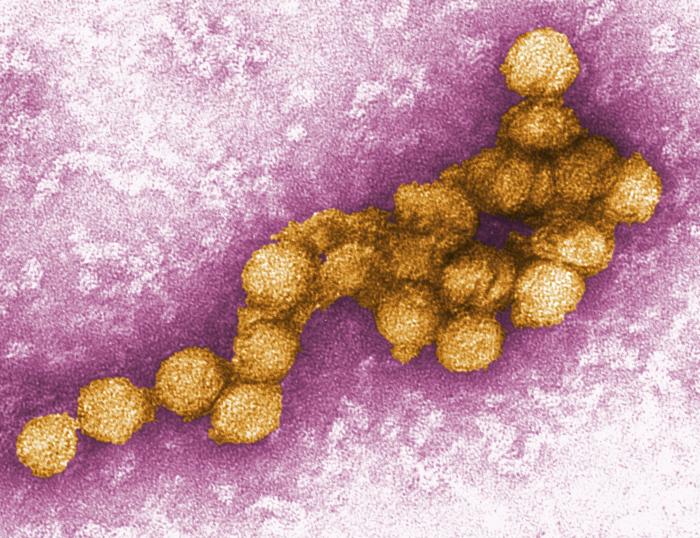 West Nile virus West Nile virus