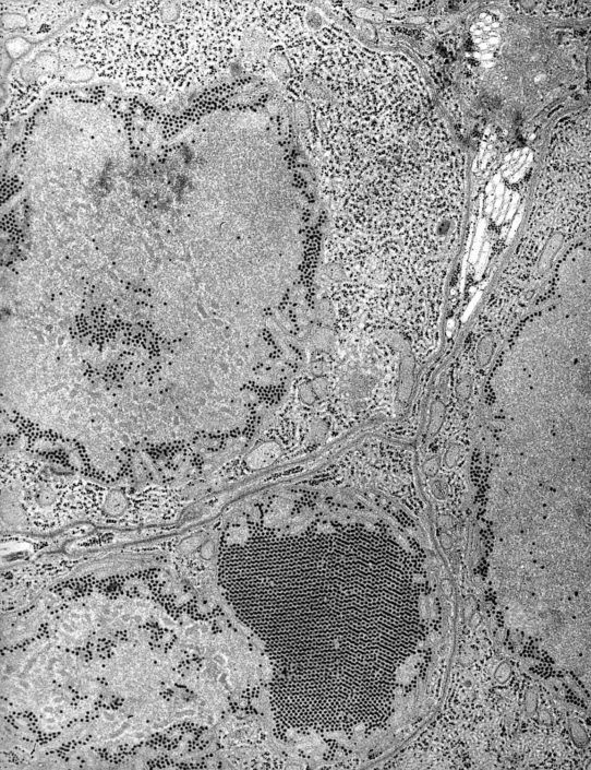 st-_louis_encephalitis_sle_virus_em_phil_1871_lores