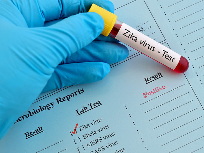 dt_160502_zika_virus_test_800x600